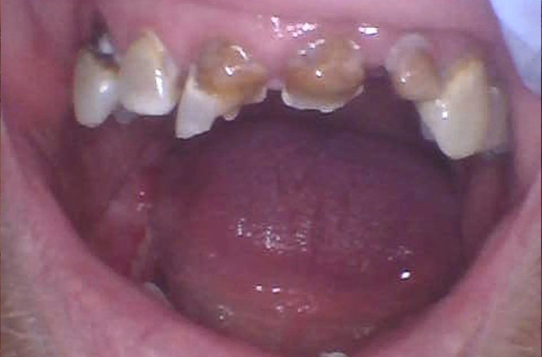 Before