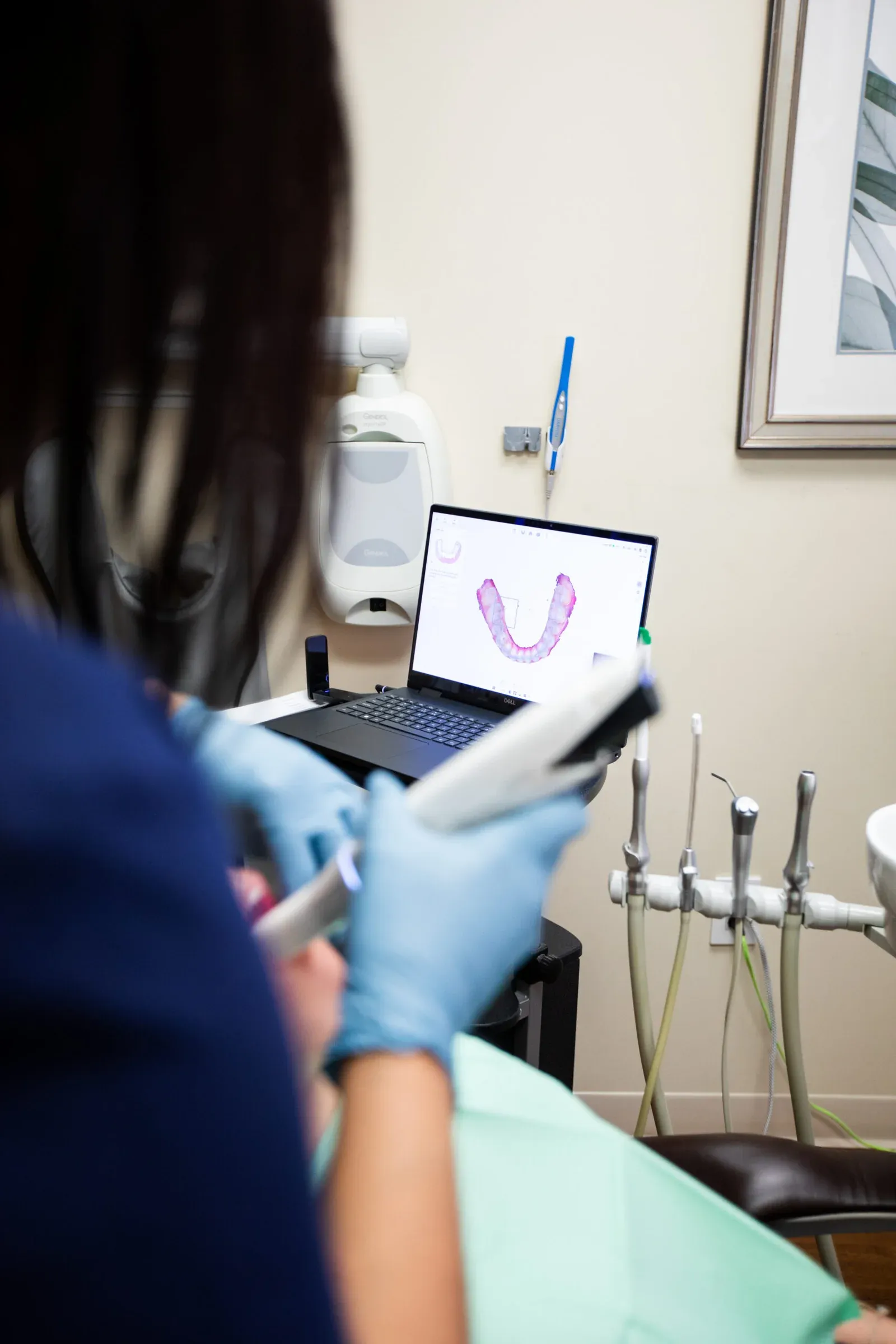 Dental staff reviewing a digital intraoral scan on a laptop at Creative Dentistry of Brooklyn Heights